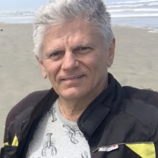Antes — Harmonização Facial